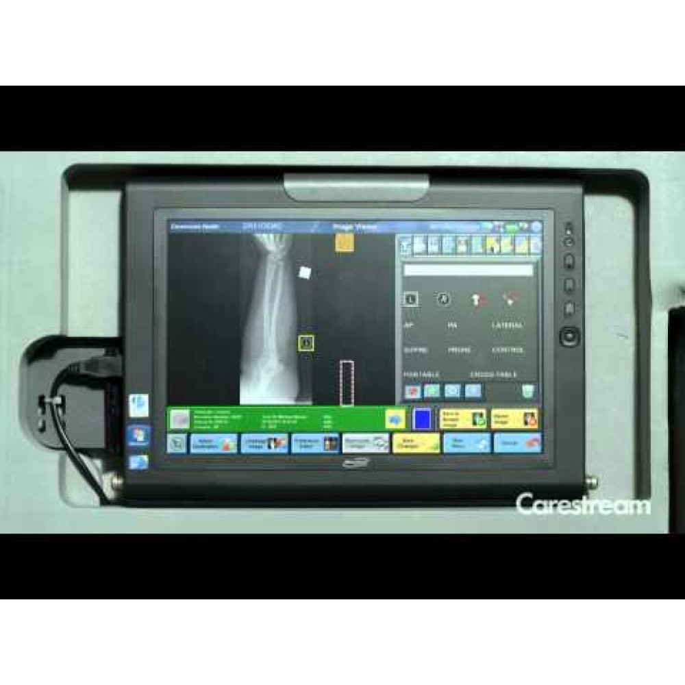 Mobile Digital Radiology DR Carestream DRX Revolution Plus Detector