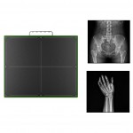 Digital Radiology DR Flat Panel Wireless 17x17 Medsinglong