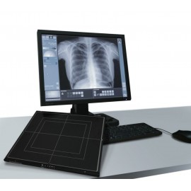 Digital Radiology DR Flat Panel Wireless 17x17 Medsinglong