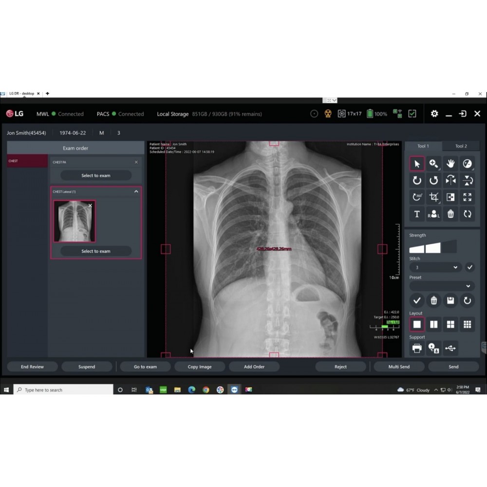 Digital Radiology DR Flat Panel Wireless LG Korea