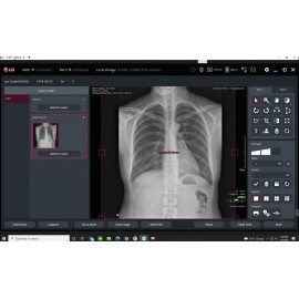 Digital Radiology DR Flat Panel Wireless LG Korea