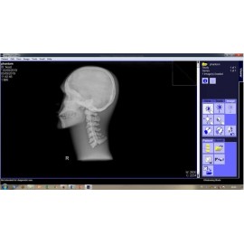 Phantom X-ray Tengkorak Kepala Cranium