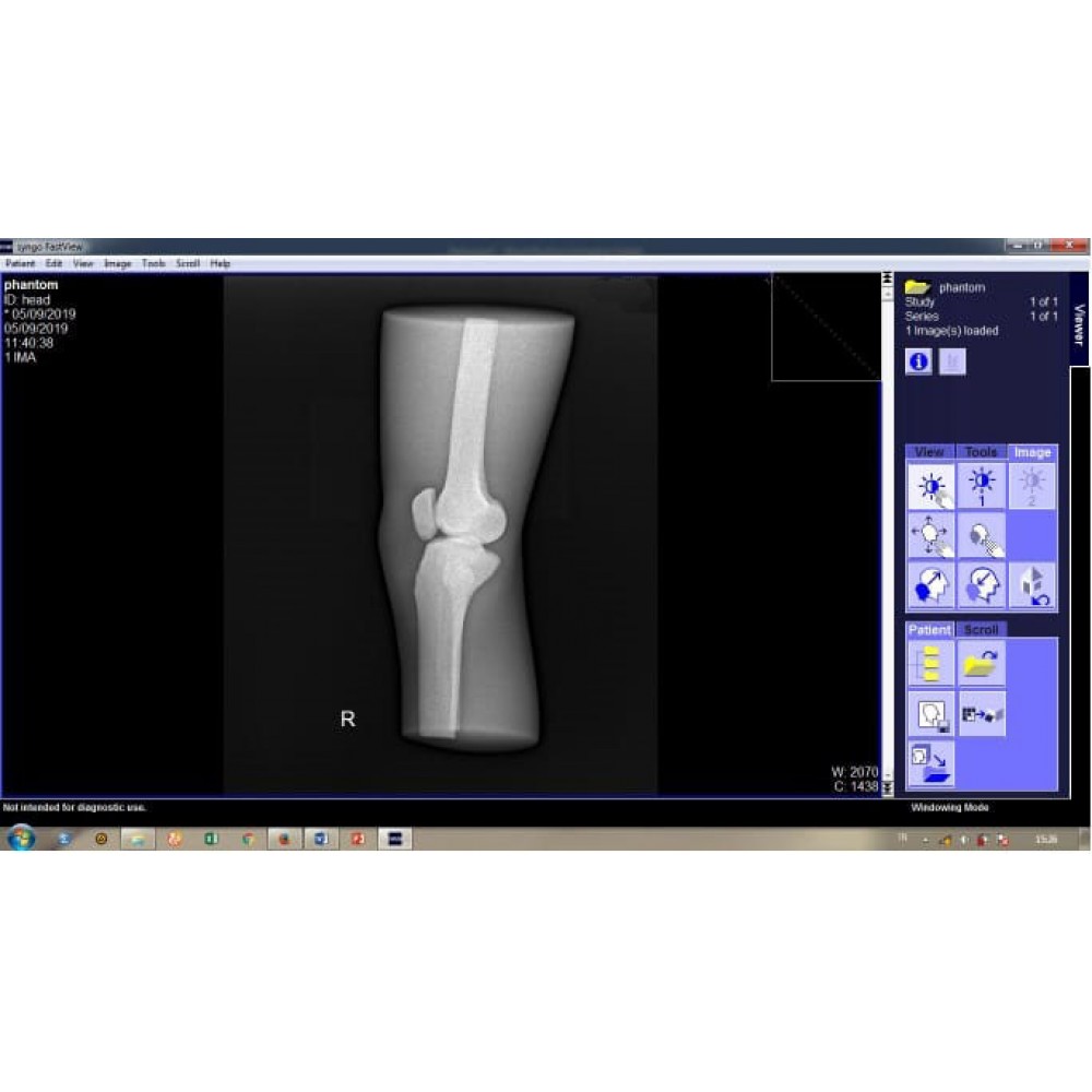 Phantom X-ray Lutut atau Genu