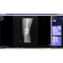 Phantom X-ray Lutut atau Genu