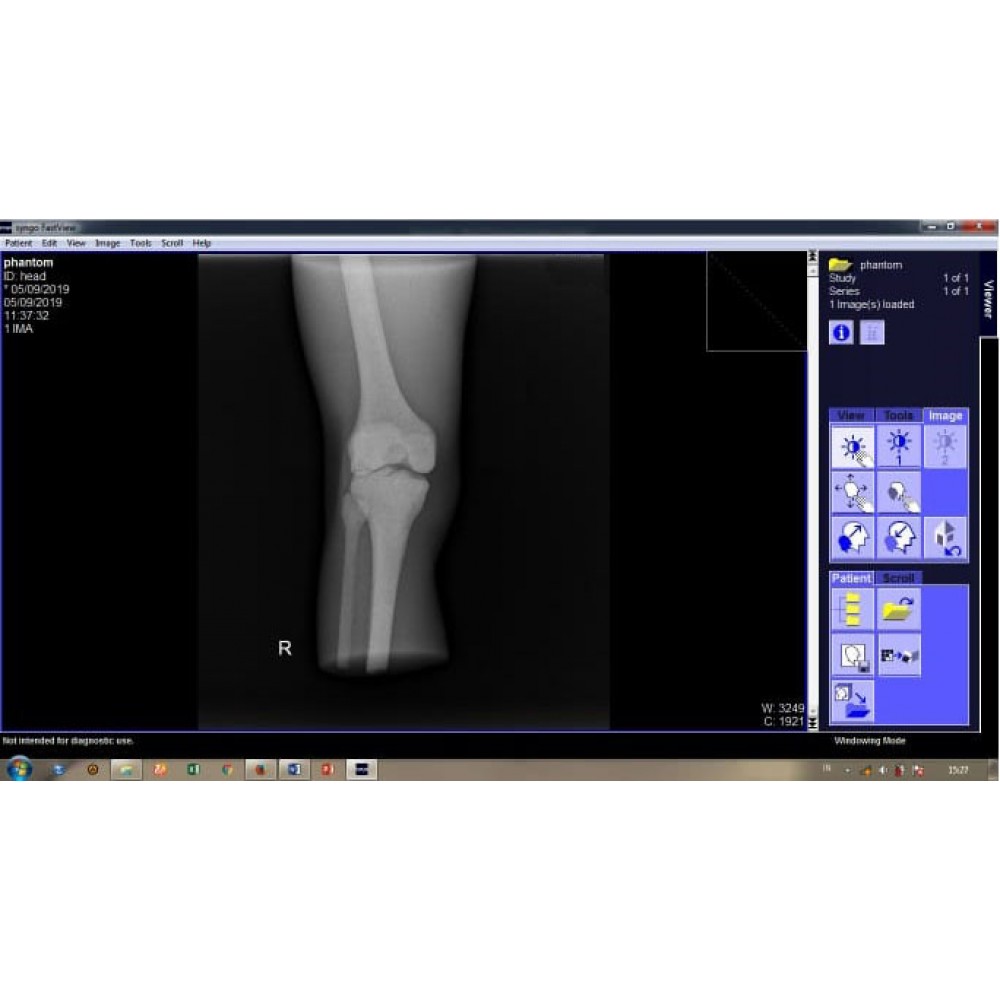 Phantom X-ray Lutut atau Genu