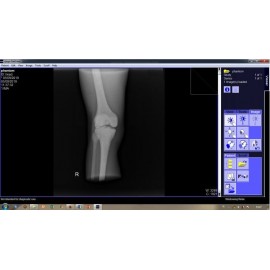 Phantom X-ray Lutut atau Genu