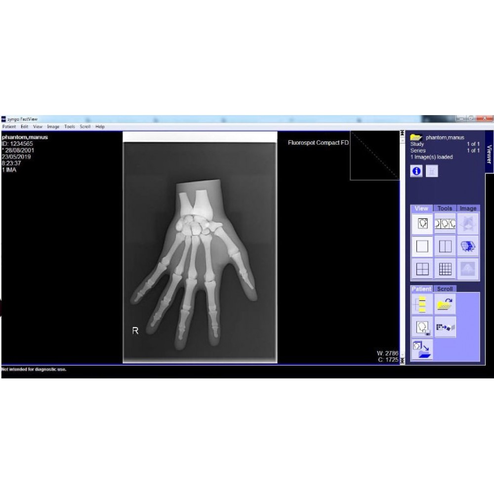 Phantom X-ray Tangan atau Manus