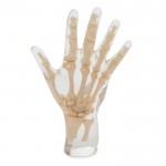 Phantom X-ray Tangan atau Manus