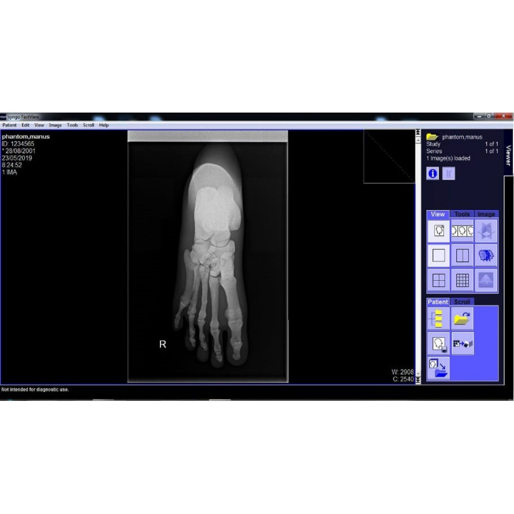 Phantom X-ray Kaki atau Pedis