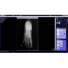 Phantom X-ray Kaki atau Pedis