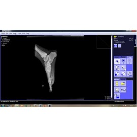 Phantom X-ray Kaki atau Pedis