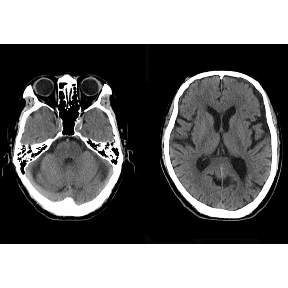 CT SCAN ANKE Anatom 16 Slice