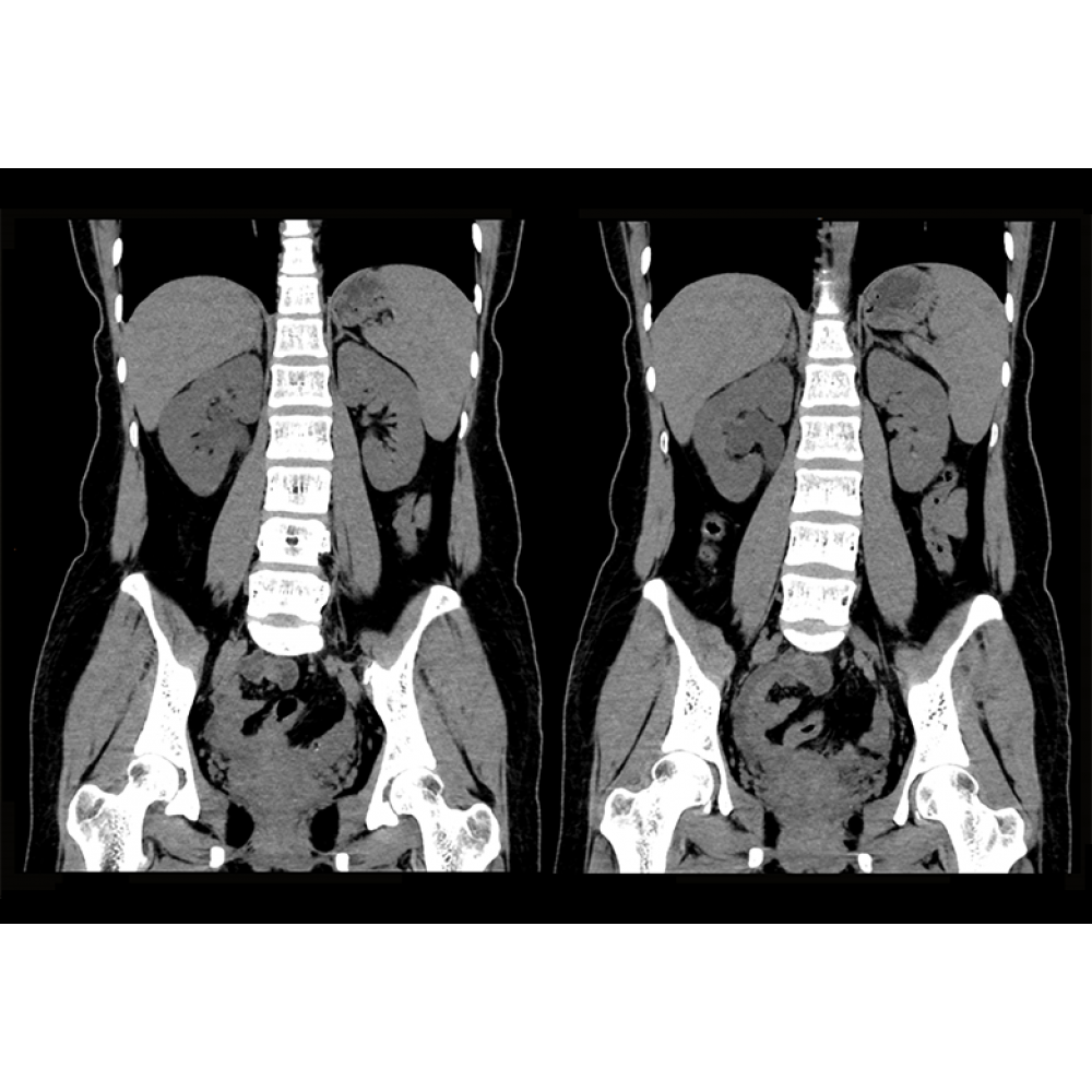 CT SCAN ANKE Anatom 16 Slice