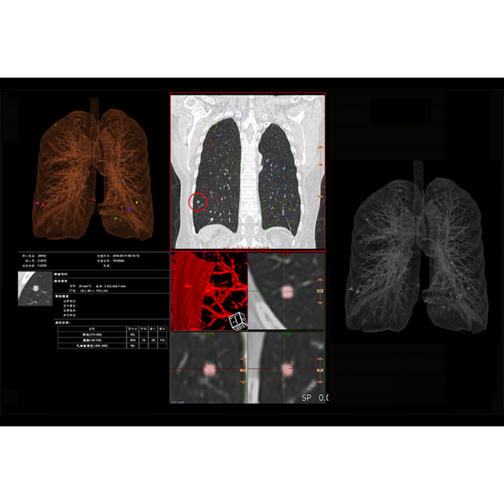 CT SCAN ANKE Anatom 16 Slice