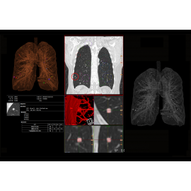 CTSCAN GE Revolution EVO 64 / 128 Slice