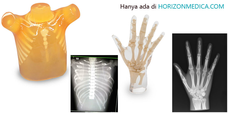 Phantom Xray